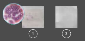 Panasonic nanoe™ X, Gegen Schimmelsporen, Foto: Fusarium